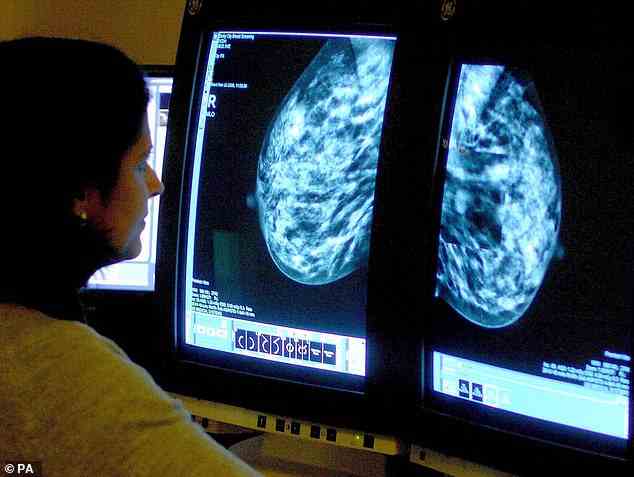 Ein Berater analysiert eine Mammographie.  Großbritanniens führende Wohltätigkeitsorganisation gegen Krebs zieht den Stecker aus Forschungszentren, die Krebspatienten potenziell lebensrettende Medikamente anbieten