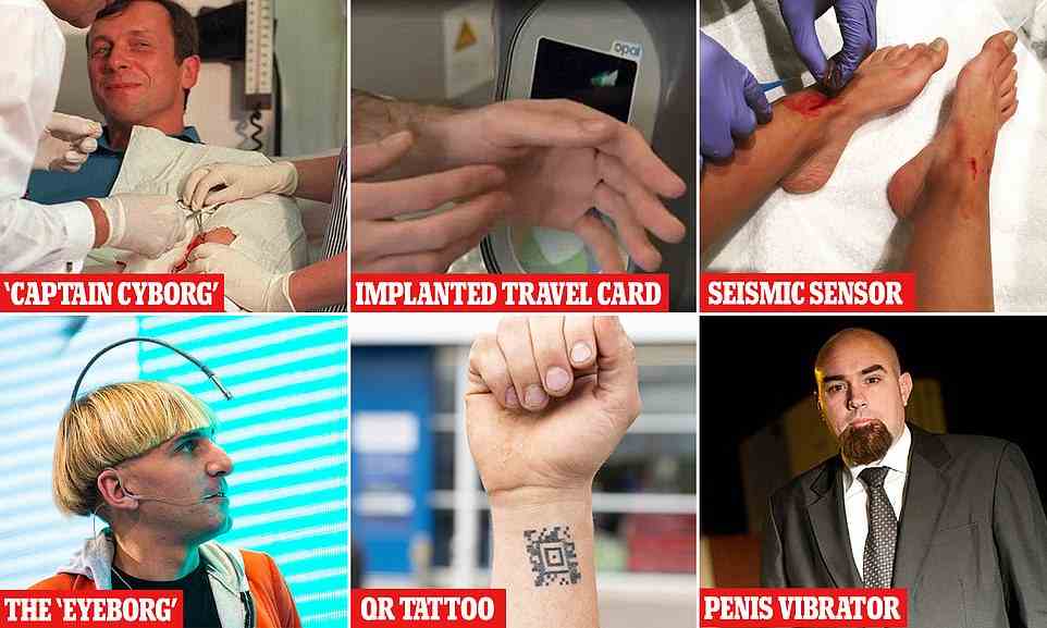MailOnline has taken a look at some of the best - and most extreme - examples of 'biohacking' - from the Sydney man with an travel card chip implanted in his hand to the 'cyborg artist' with an antenna on his head, and one of the first biohackers, Professor Kevin Warwick, an engineer at Coventry University