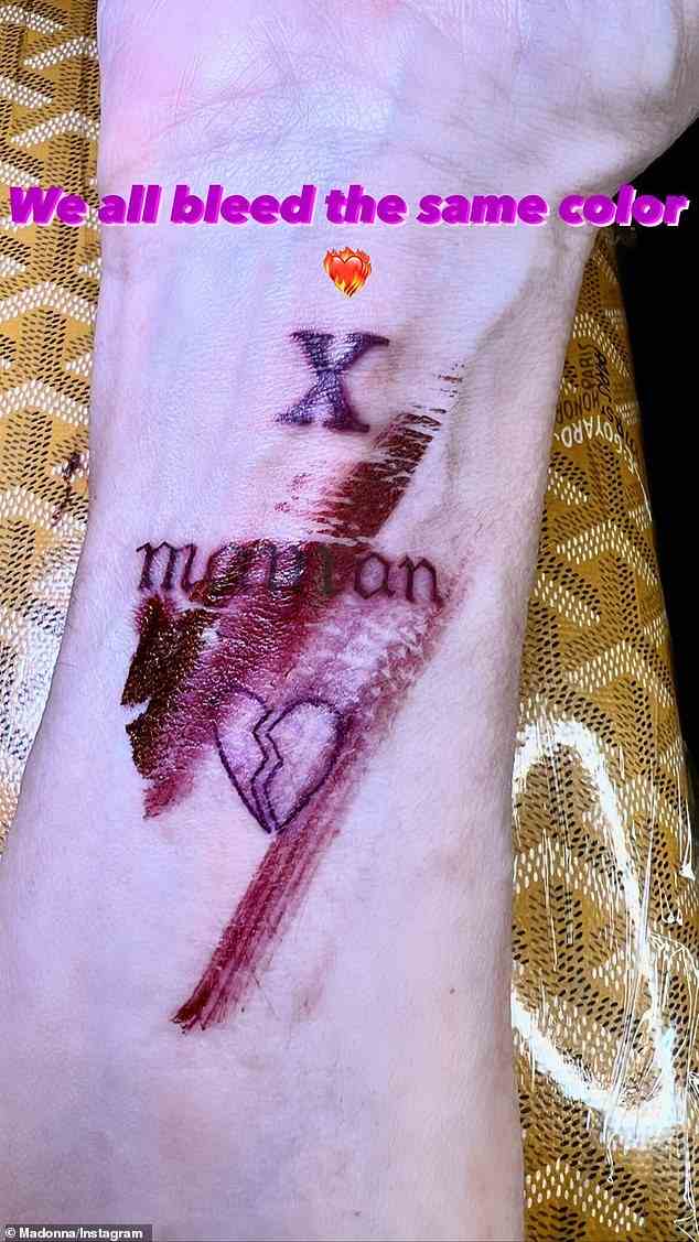 Blutig: Das nächste Bild zeigte das Tattoo, das direkt nach dem Tattoo mit ihrem Blut verschmiert war, mit der Aufschrift „Wir bluten alle in derselben Farbe“.