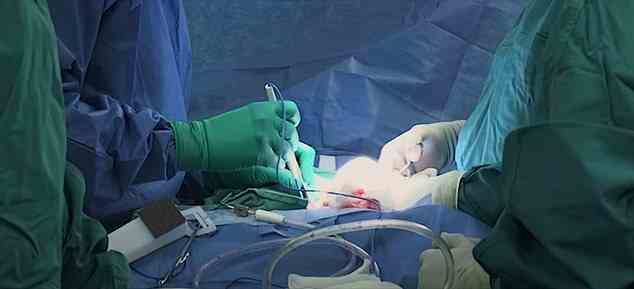Oben abgebildet ist die Operation, bei der Owens verschmolzene Arterien getrennt und die Herzklappen ersetzt wurden