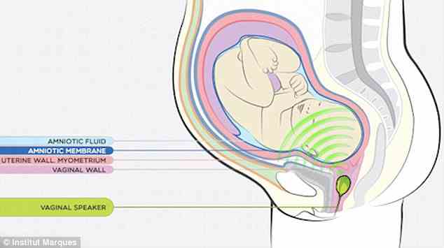 Researchers demonstrated how a small, silicone speaker is inserted like a tampon and plays music directly to the fetus