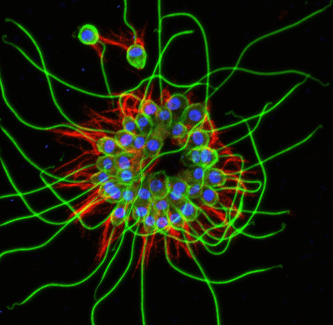 Ein Foto einer Kolonie von B. monosierra choanoflagellates.