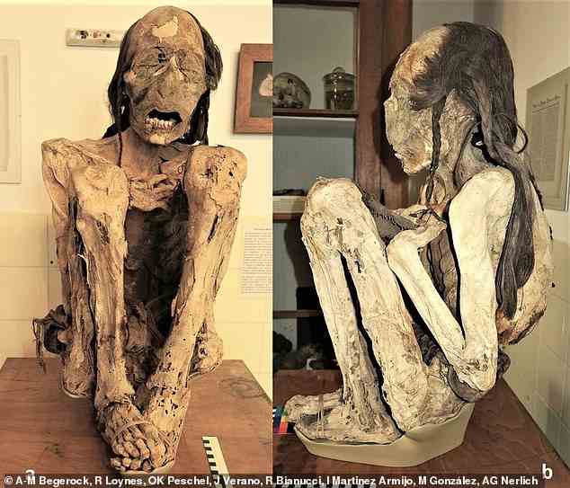 Nach der Analyse mit 3D-CT glauben die Wissenschaftler, dass die Marburger Mumie (im Bild) starb, nachdem sie einen Schlag mit voller Wucht auf den Kopf erhalten hatte und dann in den Rücken gestochen wurde, während sie noch stand oder kniete.  Laut Radiokohlenstoffdatierung könnten die Verletzungen von einem Angreifer oder einem Hinterhalt von zweien zwischen 996 und 1147 n. Chr. Zugefügt worden sein