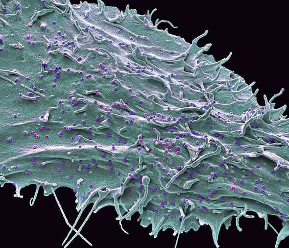 SIV infiziert menschliche Zellen unter einem Mikroskop