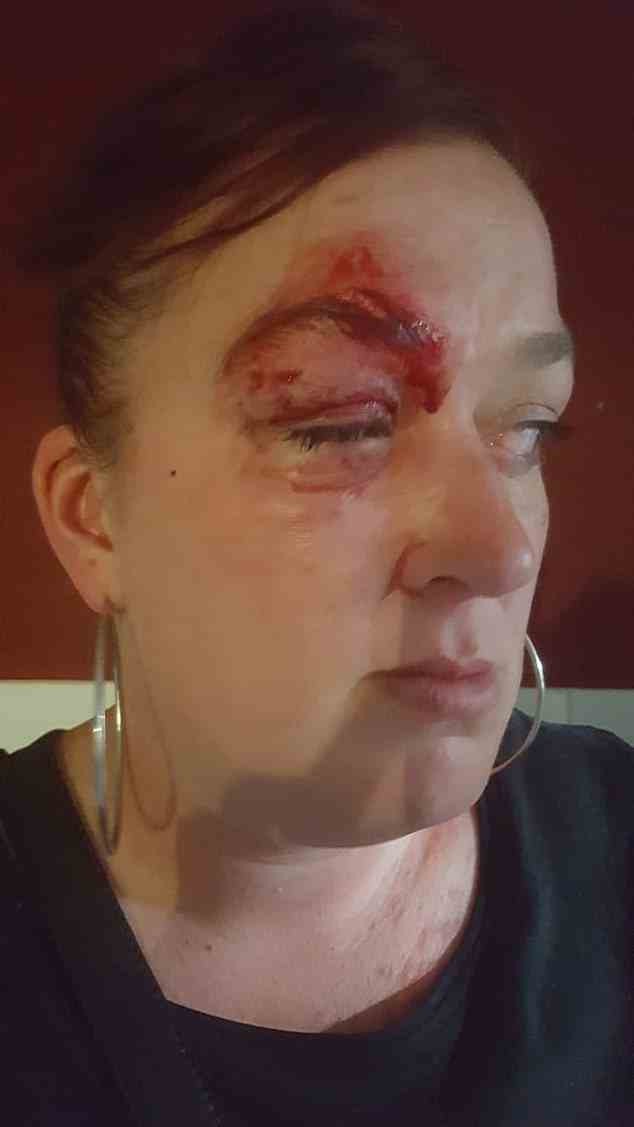 Shar Grace Hounsley, 34, hat diese Fotos mutig gepostet, um das Ausmaß der häuslichen Gewalt zu zeigen, die sie durch ihren Partner erlitten hat