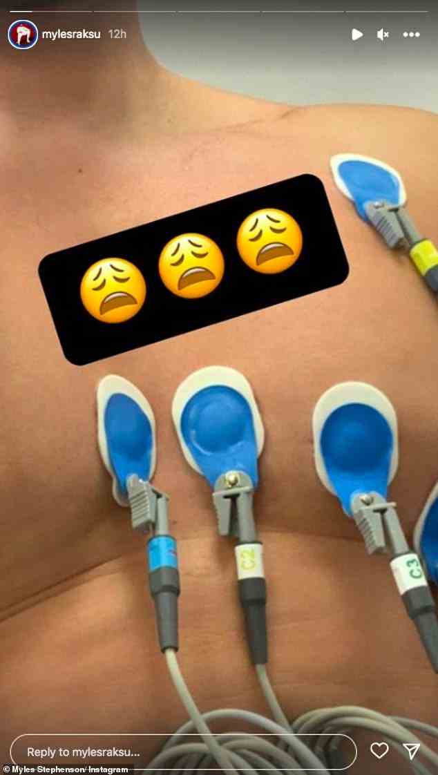 Gruselig: Der Rak-Su-Sänger, 31, sagte am Freitag in Social-Media-Beiträgen, dass er an hypertropher Kardiomyopathie leidet, als er einen Schnappschuss von Monitoren auf seiner Brust teilte