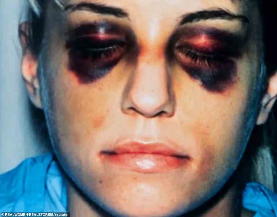In January of 1993, however, Karla decided to leave Paul after he allegedly beat her with a flashlight, leaving her with two black eyes and a broken rib