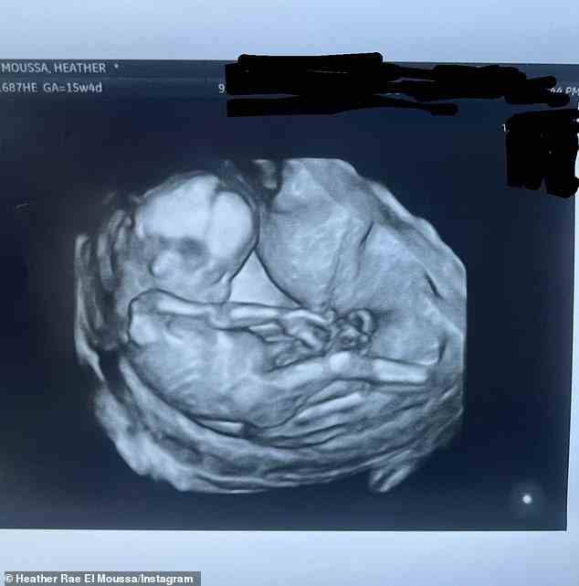 „Es war so besonders“: Das erste Kind der Maklerin der Oppenheim-Gruppe mit Tarek wird „Anfang 2023“ erwartet, und sie gab ihren Fans am 9. August einen 4-D-Ultraschall-Einblick in ihren ungeborenen Sohn