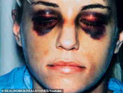 In January of 1993, however, Karla decided to leave Paul after he allegedly beat her with a flashlight, leaving her with two black eyes and a broken rib