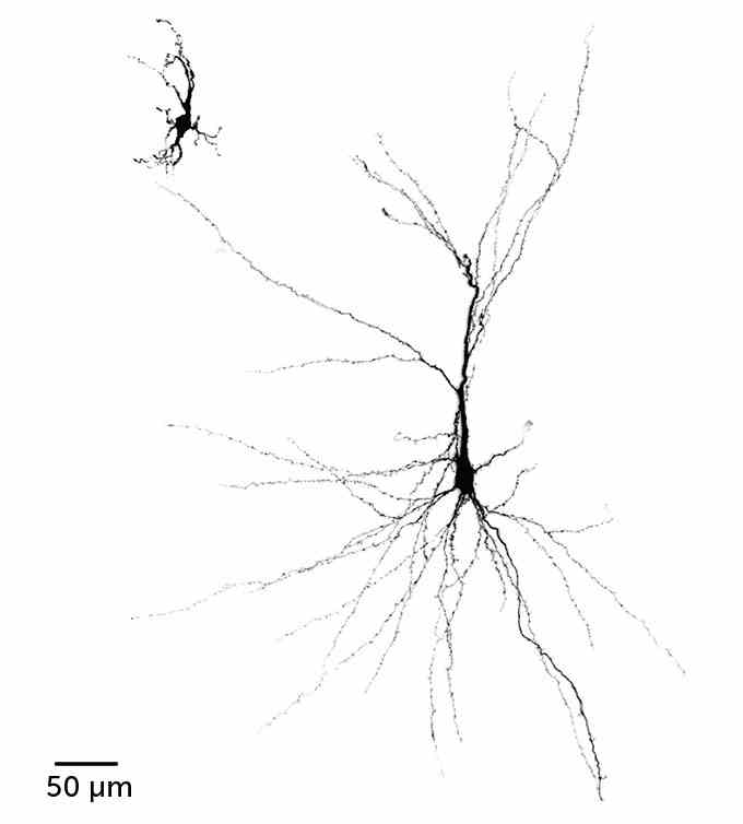 Oben links: Eine aus einem Organoid gezüchtete menschliche Nervenzelle in einer Laborschale.  Sie ist viel kleiner und hat viel kürzere „Ranken“ als die Nervenzelle eines Organoids, das in einem Rattengehirn gewachsen ist, das lange, dünne „Ranken“ hat, die den größten Teil des Bildes bedecken