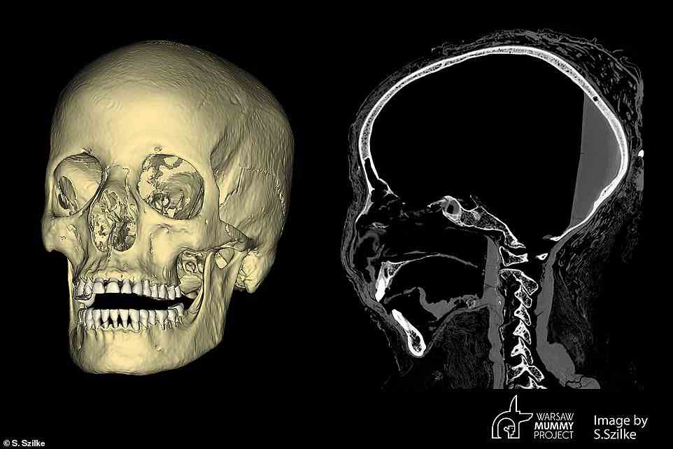 Forensic experts used her skull (pictured) and other remains to produce two images showing what 'The Mysterious Lady; may have looked like when alive in the first century BC