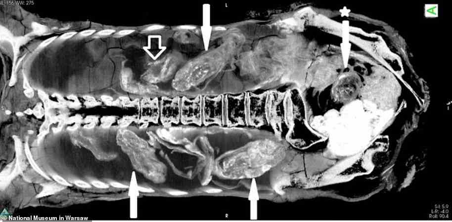 Some experts at the Warsaw Mummy Project claimed that what appeared to be a foetus in X-ray scans and CT images was actually 'a computer illusion and misinterpretation'. They say some of the objects depicted here with arrows were wrongly identified as a foetal head and body. However, two members of the project, Marzena Ozarek-Szlike and Wojciech Ejsmond, have dismissed these claims