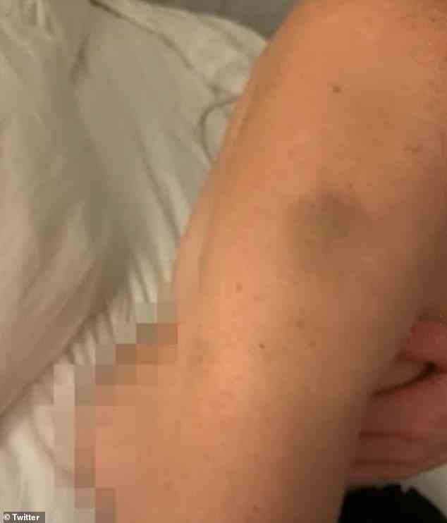 Her lawyers are claiming the photos are enough proof to put her on house arrest, but prosecutors claim the bruises were already on her body in Instagram posts before the day of the killing