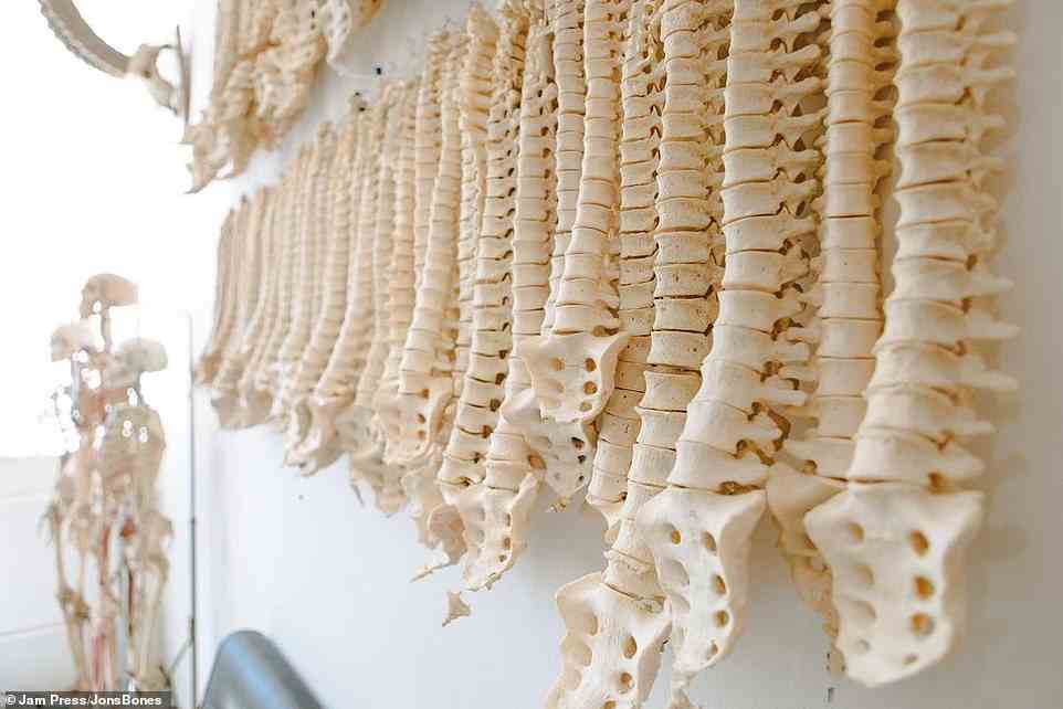 Das Museum verfügt über eine Wand, die mit 110 menschlichen Stacheln gefüllt ist.  Alle Knochen wurden einst für medizinische oder pädagogische Zwecke verwendet und sind legal zu besitzen.  Viele der Überreste waren in den 1950er Jahren im Besitz von Ärzten und Professoren, die inzwischen verstorben sind und die Knochen ihren nächsten Angehörigen hinterlassen haben