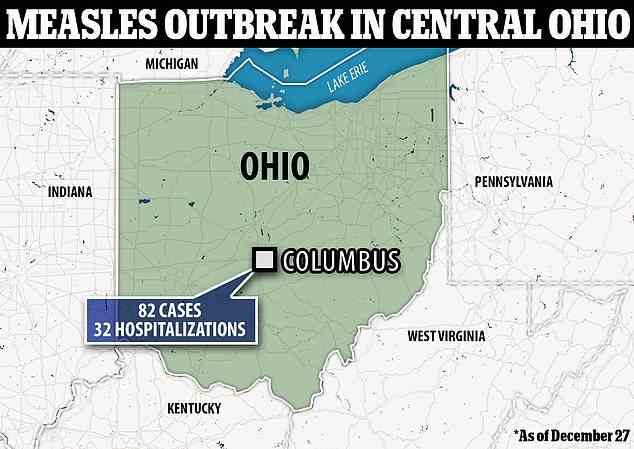 Beamte in Zentral-Ohio haben in diesem Jahr 82 Masernfälle registriert, von denen 32 ins Krankenhaus eingeliefert werden mussten.  Es wurden keine Todesfälle mit diesem Ausbruch in Verbindung gebracht