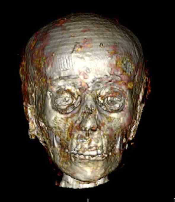 Ein CT-Scan des Kopfes der Mumie