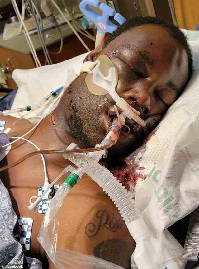 Nichols ist nach dem Vorfall im Krankenhaus abgebildet.  Der 29-Jährige aus Memphis starb am 10. Januar an Herzstillstand und Nierenversagen, drei Tage nachdem er von der Polizei wegen rücksichtslosen Fahrens in nicht gekennzeichneten Autos angehalten worden war