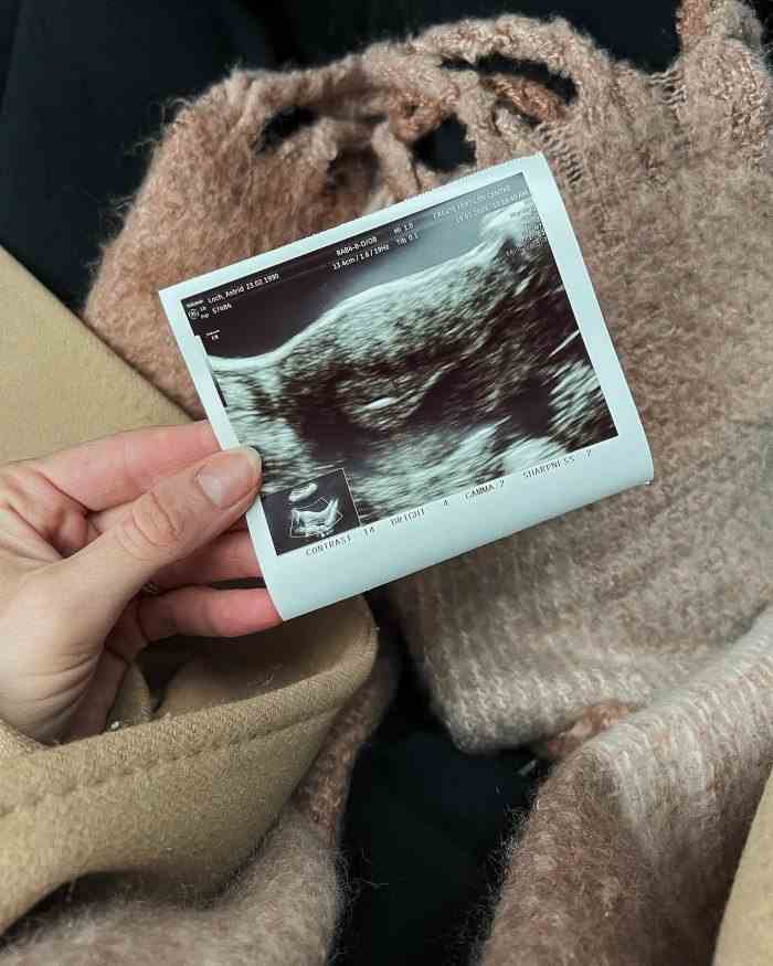 Astrid Loch von Bachelor in Paradise ist schwanger und erwartet Baby Nr. 2 mit Ehemann Kevin Wendt nach IVF-Reise: Details