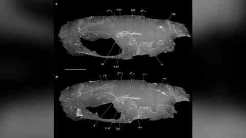 Die Gehirnstruktur des Vorderhirns von C. wildi ähnelt eher der anderer Wirbeltiere als der anderer Strahlenflossenfische, sagten die Studienautoren. 