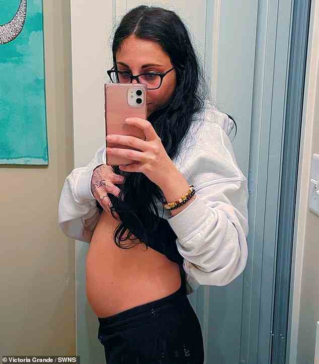 Victoria Grande, 29, die so aufgebläht war, dass sie aussah, als wäre sie in der 20. Woche schwanger, entdeckte, dass sie tatsächlich eine 11 cm große Zyste hatte, aus der Haare und Haut wuchsen