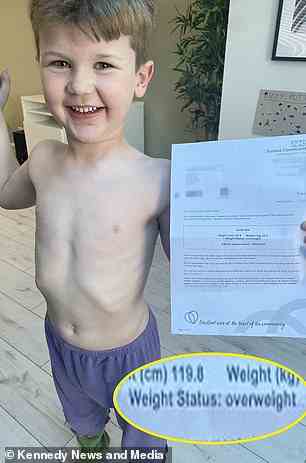 Der Ernährungswissenschaftler Aaron Nee hat die BMI-Prüfungen des NHS als „idiotisch“ eingestuft, nachdem sein schlanker fünfjähriger Sohn als übergewichtig eingestuft wurde