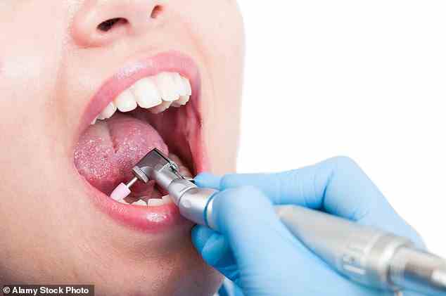 EXPERTENURTEIL: „Der beste Weg, Zahnstein zu entfernen, ist, einen ausgebildeten Hygieniker aufzusuchen, der einen Ultraschallreiniger mit doppelter oder dreifacher Vibration pro Minute verwendet.“ 0/10