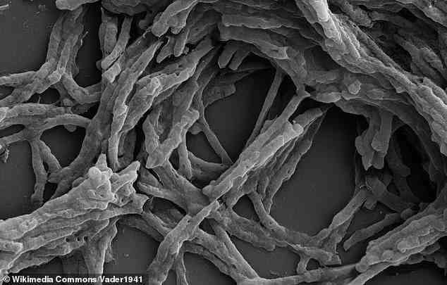 Sie konnten es aus einem gewöhnlichen, im Boden lebenden Bakterium namens Mycobacterium smegmatis extrahieren.  Im Bild: Rasterelektronenmikroskopische Aufnahme von Mycobacterium smegmatis