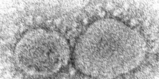 DATEI – Dieses elektronenmikroskopische Bild aus dem Jahr 2020, das von den Centers for Disease Control and Prevention zur Verfügung gestellt wurde, zeigt SARS-CoV-2-Viruspartikel, die COVID-19 verursachen. 