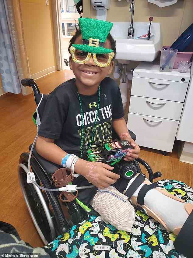 Kaden Stevenson, 7, aus Michigan, wurden beide Beine amputiert, nachdem bei ihm das toxische Schocksyndrom diagnostiziert worden war.  Sein rechtes Bein wurde oberhalb des Knies und das linke unterhalb des Knies amputiert