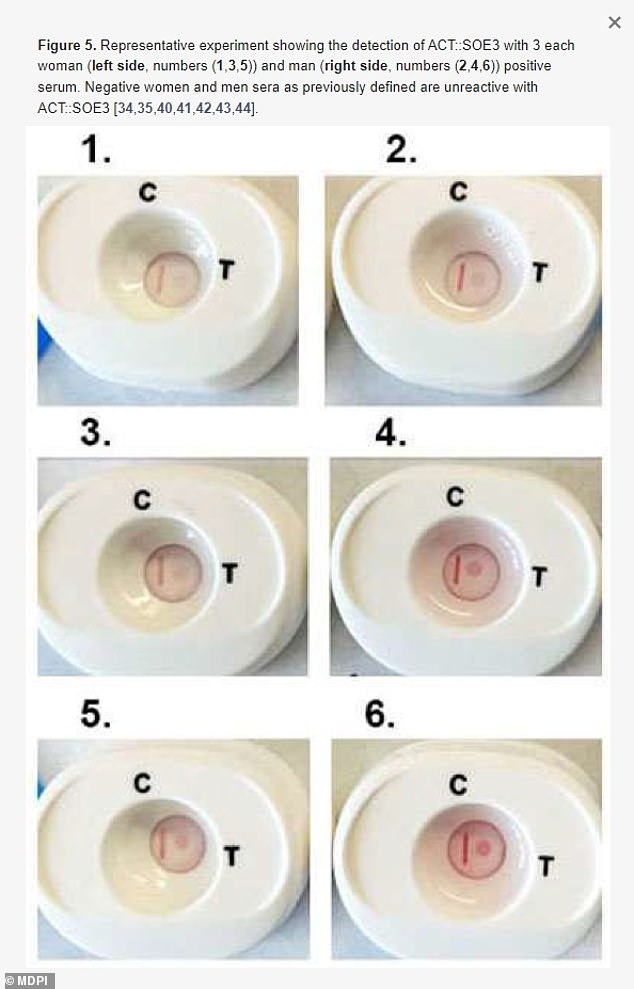 Einmal diagnostiziert, lässt sich Trichomoniasis, die durch den Parasiten Trichomonas vaginalis verursacht wird, leicht mit Antibiotika heilen (Bild: positive Tests bei einer Frau (1,3,5) und einem Mann (2,4,6))