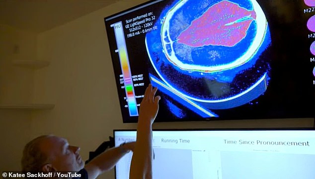 Pictured: Brain scans of a patient that chose to have the organ frozen and maintained to be revived in the future. The Alcor team is hopeful technology to rebuild the body around the brain would allow for it to be implanted into a new body in the future