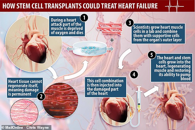 In 2019, Cambridge University researchers regenerated lost heart muscle and blood vessels in rats with damaged hearts after transplanting stem cells from a human heart