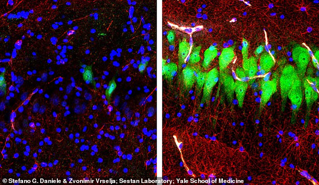 Immunofluorescent stains for neurons (green), astrocytes (red), and cell nuclei (blue) in a region of a pig’s brain left untreated 10 hours after death (left) or subjeted to the Yale technology (right)