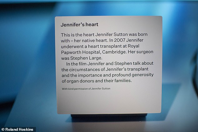 Im Bild: Jennifer Suttons Heimat-Herz-Ausstellung.  Besucher können ihre Geschichte im Film „Transforming Lives“ verfolgen, in dem Jennifer und ihr Chirurg Stephen Large von Jennifers lebensrettender Herztransplantation erzählen