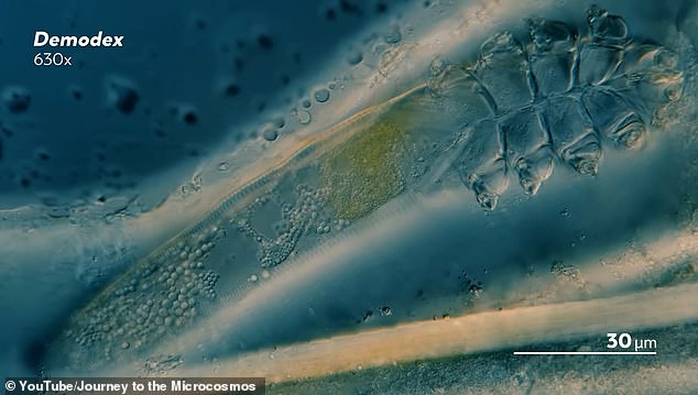 Die Bilder zeigen kugelförmige Tröpfchen am Ende des Demodex-Körpers, bei denen es sich um Öltröpfchen und die verdauten Talgreste unserer Haut handelt