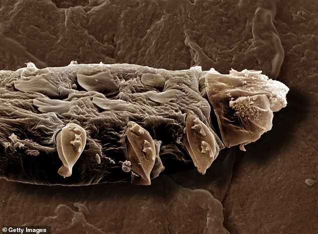 Diese Rasterelektronenmikroskopaufnahme (REM) zeigt eine der auf Menschen lebenden Arten – Demodex folliculorum