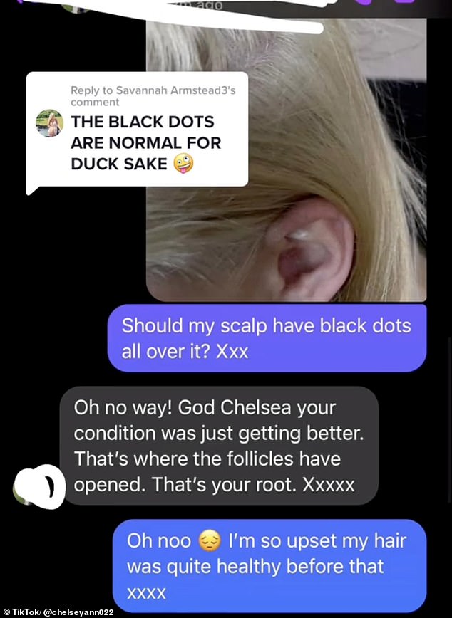 In einem anderen Video enthüllte Chelsy Ann, dass ihr üblicher Friseur sagte, die schwarzen Wurzeln auf ihrer Kopfhaut seien auf das Öffnen der Follikel zurückzuführen