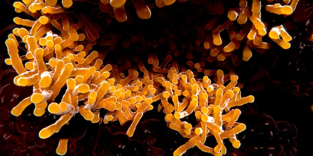 Tuberkulosebazillus 