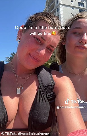 Ellie Buchanan aus St. Louis in Missouri hat ein Video geteilt, das den Verlauf ihres Sonnenbrandes nach einer Reise nach Florida zeigt