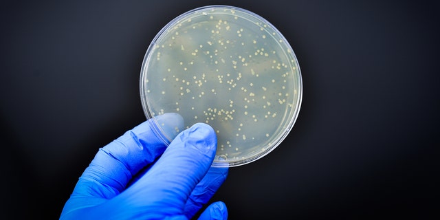 Bakterien in einer Kulturplatte