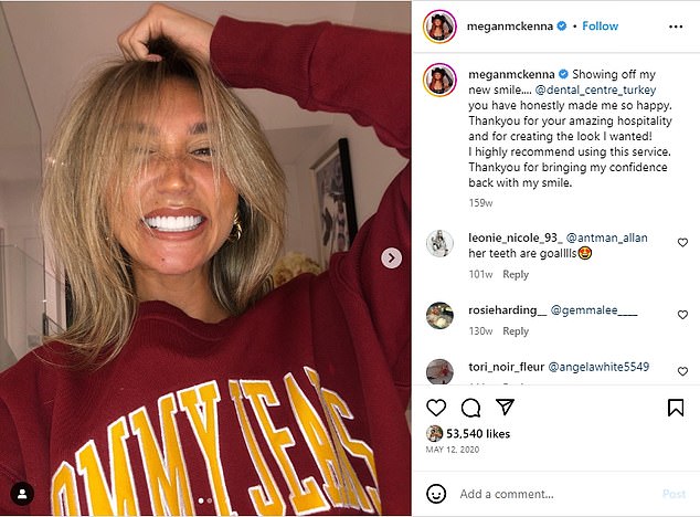 Ex-TOWIE star Megan McKenna, 30, showed her veneers off in an Instagram post in 2020