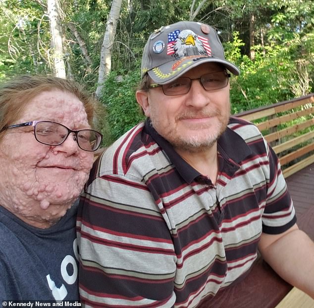 Frau Christensen ist seit 14 Jahren mit ihrem Ehemann Rodney, 58, verheiratet.  Sie sagte, er gebe ihr ein schönes Gefühl, „trotz der Tumore“.
