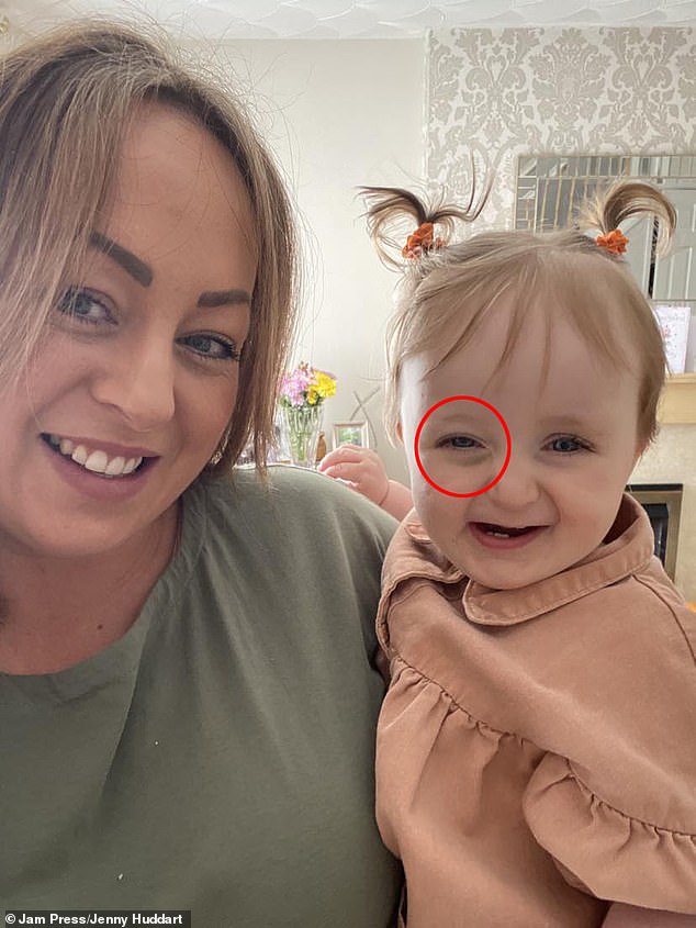 Das Auge der Einjährigen begann sich zu verformen und fiel ihr ins Gesicht, doch der Hausarzt wies sie ab
