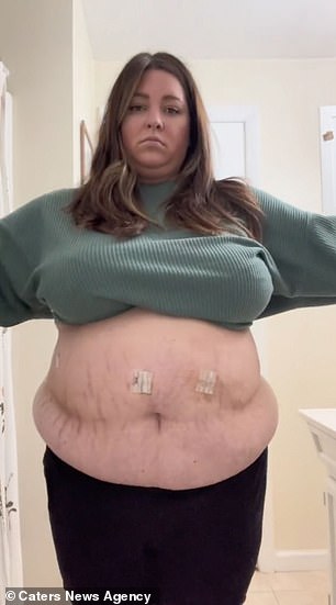 Sharing a clip on her TikTok the beauty showcased her incredible transformation with her followers (pictured prior to her weight loss journey)