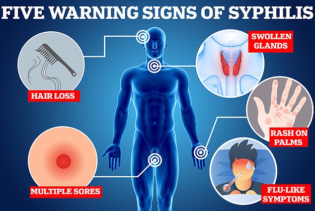 Syphilis wird oft als „die große Heuchlerin“ bezeichnet, da die Symptome der Krankheit sich mit mehreren anderen sexuell übertragbaren Krankheiten überschneiden, was dazu führen kann, dass medizinisches Fachpersonal die Symptome völlig übersieht.  Hier sind fünf Warnzeichen der Krankheit, auf die Sie achten sollten