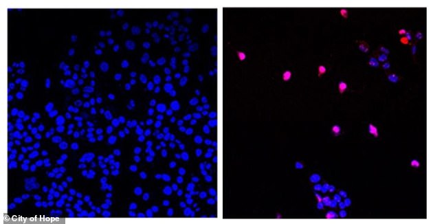 Untreated cancer cells are seen on the left and cancer cells treated with AOH1996 undergoing programmed cell death (in violet) are pictured on the right. AOH1996 targets a cancerous variant of the protein PCNA. In its mutated form, PCNA is critical in DNA replication and repair of all expanding tumors
