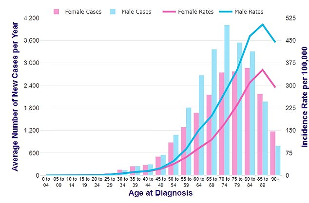 This chart shows the average number of bowel cancer cases per year in men and women (blue and pink line respectively) and across different age groups (blue and pink bars)