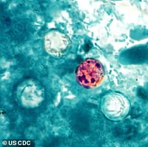 Cyclospora, ein mikroskopisch kleiner Parasit (im Bild), kann explosiven Durchfall, Magenkrämpfe und Blähungen verursachen.  Die Krankheit kann länger als einen Monat andauern, die meisten Fälle verschwinden jedoch innerhalb weniger Tage