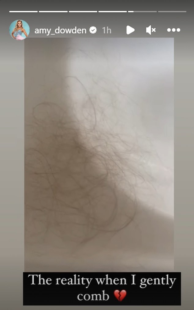 Verheerend: In einem emotionalen Instagram-Post verriet Amy, dass ihr das Herz gebrochen sei, da ihre Haare auszufallen begannen