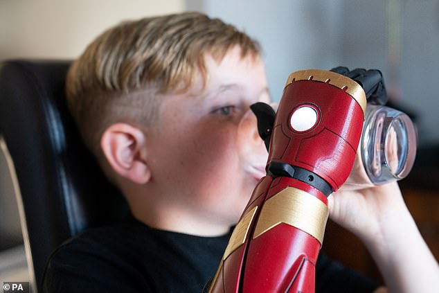 Der Siebenjährige wurde ohne Arm geboren, kann die 13.000 Pfund teure Prothese nun für eine Vielzahl alltäglicher Aufgaben nutzen